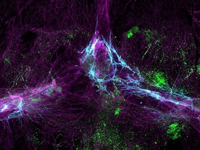 how the brain choreographs immune responses
