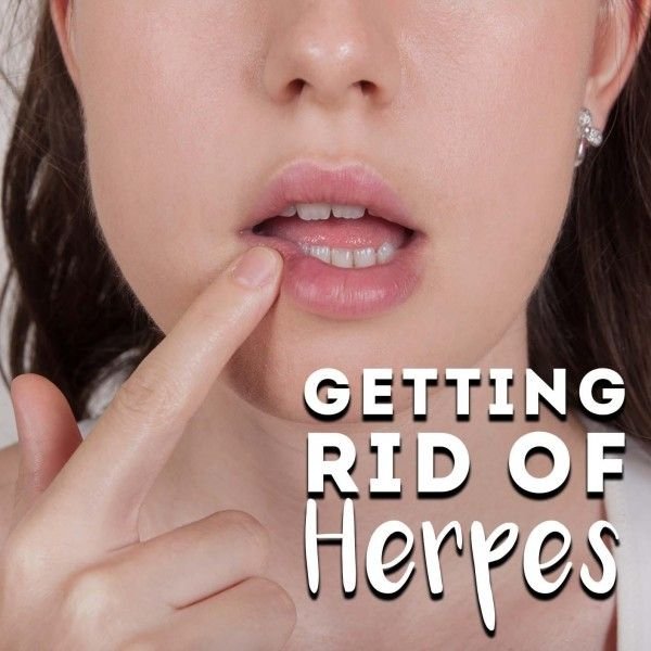 Manage Herpes Hypnosis